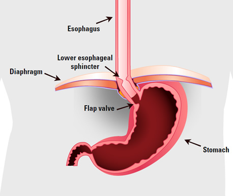 Close up pf lower esophageal sphincter